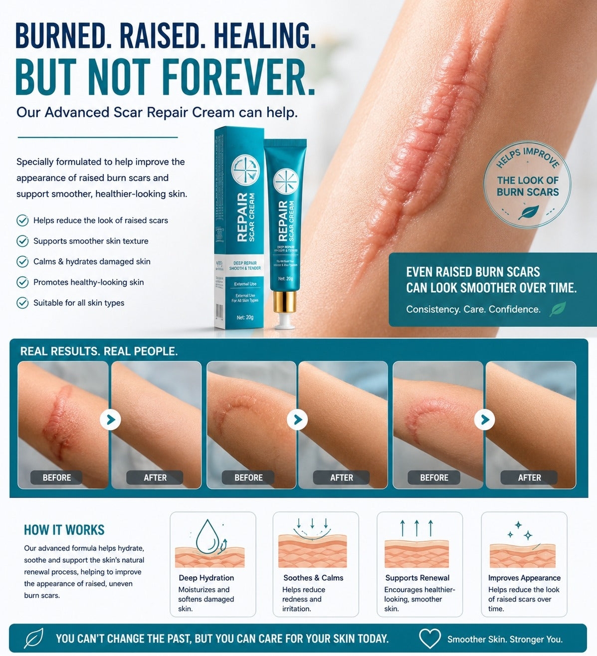 Raised burn scar care and results