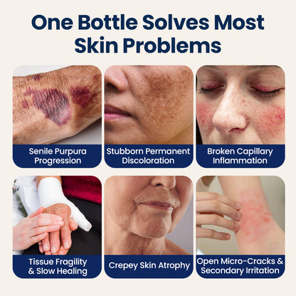 Buy 1 Get 1 Free💙ResiliVeil Bruise Appearance Barrier Care Cream