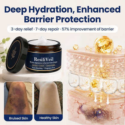 Buy 1 Get 1 Free💙ResiliVeil Bruise Appearance Barrier Care Cream