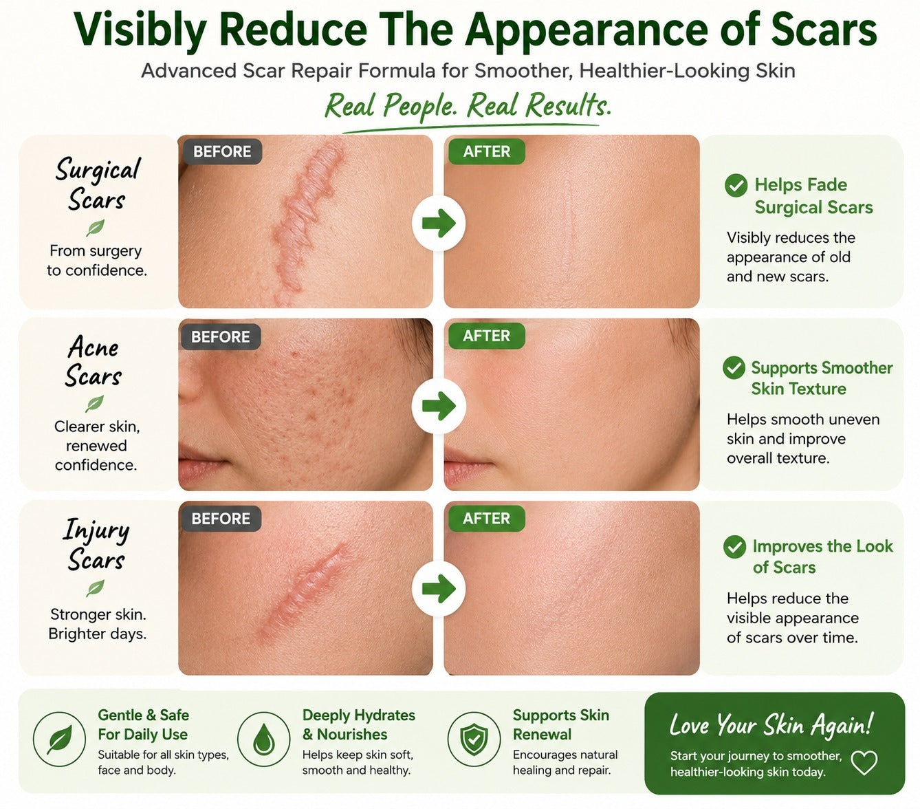 Surgical acne and injury scar before and after results