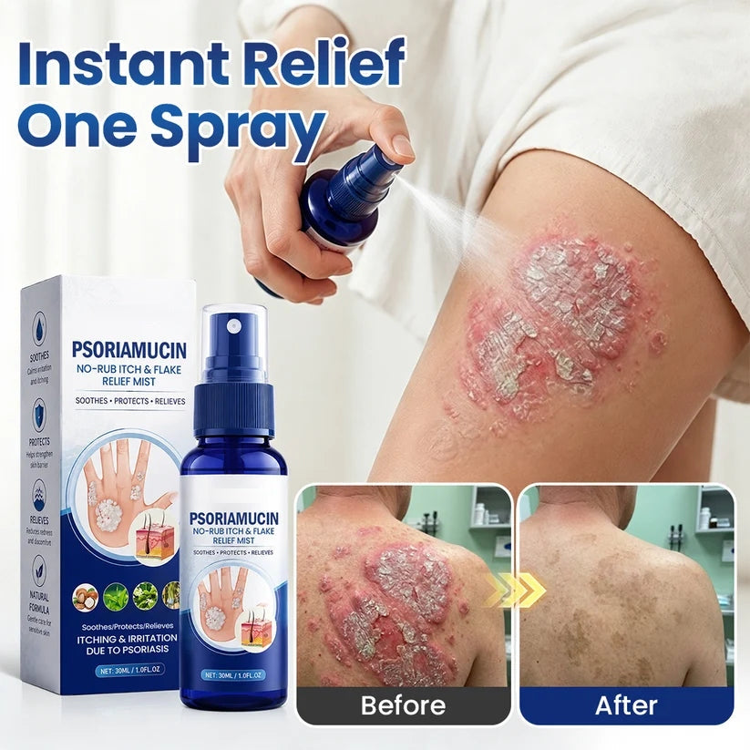 PsoriaMucin No-Rub Itch & Flake Relief Mist