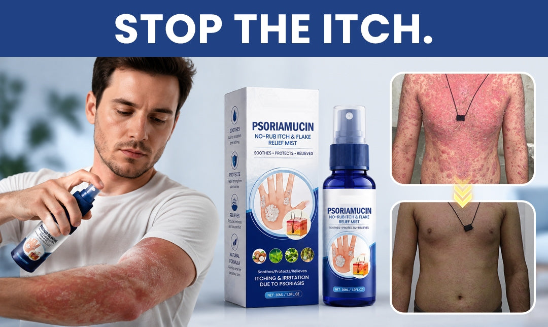 Stop the itch