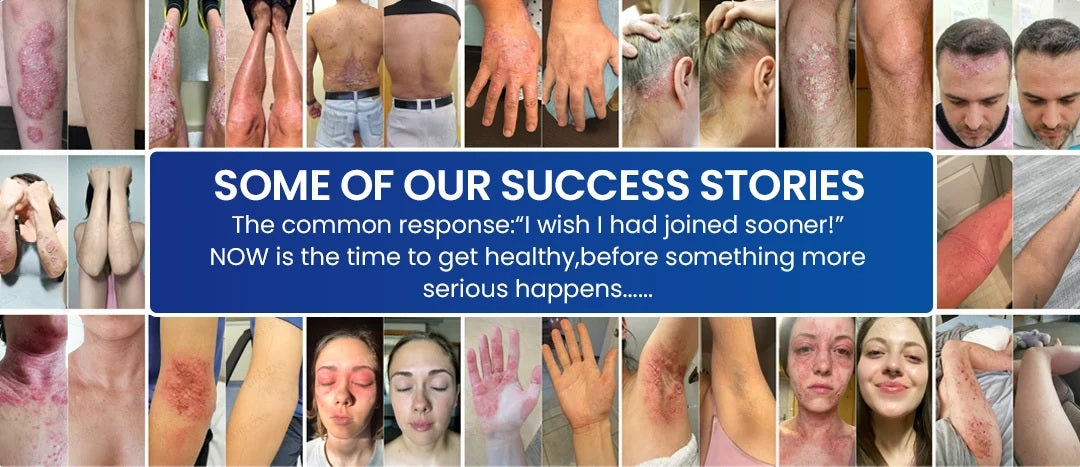 Success stories