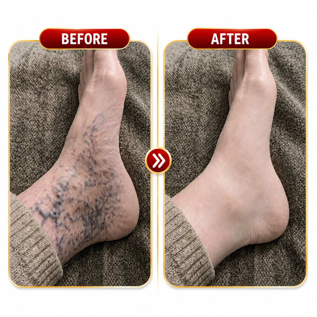 Before and after comparison of visible veins around an ankle and foot